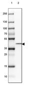 Hydroxysteroid 11-Beta Dehydrogenase 2 antibody, PA5-59904, Invitrogen Antibodies, Western Blot image 