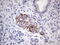 Protein O-Mannose Kinase antibody, M10251, Boster Biological Technology, Immunohistochemistry paraffin image 