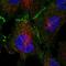 Tumor Protein P53 Binding Protein 2 antibody, HPA050429, Atlas Antibodies, Immunofluorescence image 