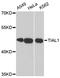 TIA1 Cytotoxic Granule Associated RNA Binding Protein Like 1 antibody, A05600, Boster Biological Technology, Western Blot image 
