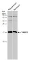 Vesicle Associated Membrane Protein 2 antibody, GTX121462, GeneTex, Western Blot image 