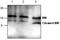Bcl-2-interacting killer antibody, GTX59922, GeneTex, Western Blot image 