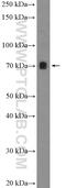 POZ-, AT hook-, and zinc finger-containing protein 1 antibody, 26225-1-AP, Proteintech Group, Western Blot image 