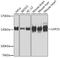 Ubiquitin Specific Peptidase 25 antibody, GTX33576, GeneTex, Western Blot image 