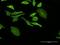 Dehydrogenase/Reductase 9 antibody, H00010170-M05, Novus Biologicals, Immunocytochemistry image 