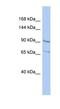Ral Guanine Nucleotide Dissociation Stimulator antibody, NBP1-56832, Novus Biologicals, Western Blot image 