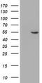 ALG2 Alpha-1,3/1,6-Mannosyltransferase antibody, TA504242, Origene, Western Blot image 
