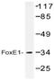 FOXE1 antibody, AP20398PU-N, Origene, Western Blot image 