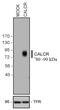 Calcitonin Receptor antibody, 702621, Invitrogen Antibodies, Western Blot image 