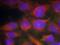 Glutamate Ionotropic Receptor NMDA Type Subunit 1 antibody, A01808-1, Boster Biological Technology, Western Blot image 