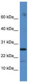 Cytochrome C Oxidase Assembly Factor COX20 antibody, TA337607, Origene, Western Blot image 