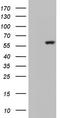 Glucosylceramidase Beta antibody, CF803361, Origene, Western Blot image 
