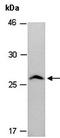 GST antibody, orb66695, Biorbyt, Western Blot image 