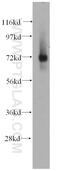 Immunoglobulin superfamily member 8 antibody, 14387-1-AP, Proteintech Group, Western Blot image 