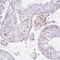 Polo Like Kinase 1 antibody, HPA051638, Atlas Antibodies, Immunohistochemistry frozen image 