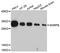 Small Nuclear Ribonucleoprotein Polypeptides B And B1 antibody, A2009, ABclonal Technology, Western Blot image 