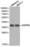COP9 Signalosome Subunit 5 antibody, LS-C192959, Lifespan Biosciences, Western Blot image 