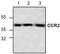 CD192 antibody, TA318908, Origene, Western Blot image 