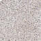 Zinc finger protein 521 antibody, HPA023056, Atlas Antibodies, Immunohistochemistry paraffin image 