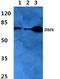 Protein DBF4 homolog A antibody, A01348, Boster Biological Technology, Western Blot image 