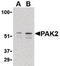 P21 (RAC1) Activated Kinase 2 antibody, LS-B537, Lifespan Biosciences, Western Blot image 