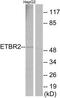 Endothelin B receptor-like protein 2 antibody, TA314886, Origene, Western Blot image 