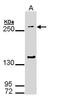 Salivary agglutinin antibody, TA308337, Origene, Western Blot image 