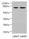 Armadillo Repeat Containing 9 antibody, CSB-PA773583LA01HU, Cusabio, Western Blot image 