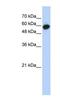 Leucine Rich Repeat Containing 6 antibody, NBP1-53157, Novus Biologicals, Western Blot image 