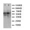 Caveolin 2 antibody, orb48007, Biorbyt, Western Blot image 