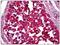 Notch Receptor 1 antibody, AP31032PU-N, Origene, Immunohistochemistry paraffin image 
