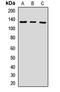 UPF1 RNA Helicase And ATPase antibody, LS-C667881, Lifespan Biosciences, Western Blot image 