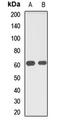 MUS81 Structure-Specific Endonuclease Subunit antibody, orb412492, Biorbyt, Western Blot image 
