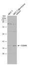Cytochrome C Oxidase Assembly Factor COX18 antibody, GTX132940, GeneTex, Western Blot image 