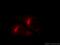 Coatomer Protein Complex Subunit Epsilon antibody, 11457-1-AP, Proteintech Group, Immunofluorescence image 