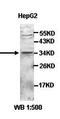 Zinc Finger CCCH-Type Containing 14 antibody, orb77738, Biorbyt, Western Blot image 