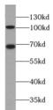 Catenin Delta 1 antibody, FNab06059, FineTest, Western Blot image 