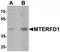 Mitochondrial Transcription Termination Factor 3 antibody, TA319912, Origene, Western Blot image 