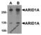 AT-Rich Interaction Domain 1A antibody, 8173, ProSci, Western Blot image 