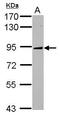 Kinesin-like protein KIF2C antibody, GTX103013, GeneTex, Western Blot image 