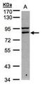 FAST Kinase Domains 1 antibody, TA307896, Origene, Western Blot image 