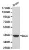 Doublecortin antibody, STJ23350, St John