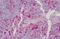 Gelsolin antibody, MBS242862, MyBioSource, Immunohistochemistry paraffin image 