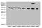 Transient Receptor Potential Cation Channel Subfamily M Member 2 antibody, A62494-100, Epigentek, Western Blot image 