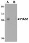 Gbp antibody, LS-B4649, Lifespan Biosciences, Western Blot image 