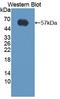 FAS antibody, LS-C373879, Lifespan Biosciences, Western Blot image 