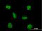 Pre-MRNA Processing Factor 4 antibody, H00009128-B01P, Novus Biologicals, Immunocytochemistry image 