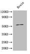 Islet cell autoantigen 1 antibody, A53268-100, Epigentek, Western Blot image 