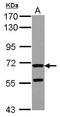 Zona Pellucida Glycoprotein 2 antibody, LS-C155477, Lifespan Biosciences, Western Blot image 