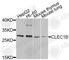 C-type lectin domain family 1 member B antibody, A9971, ABclonal Technology, Western Blot image 